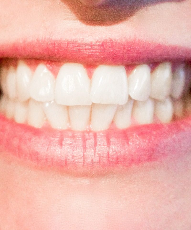 Nowoczesna technologia używana w salonach stomatologii estetycznej może spowodować, że odbierzemy prześliczny uśmiech.